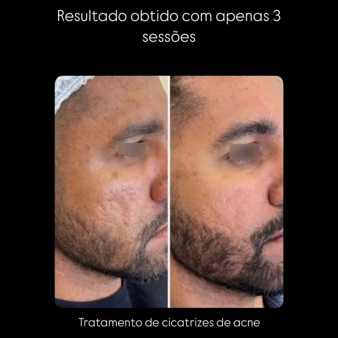 lee2
